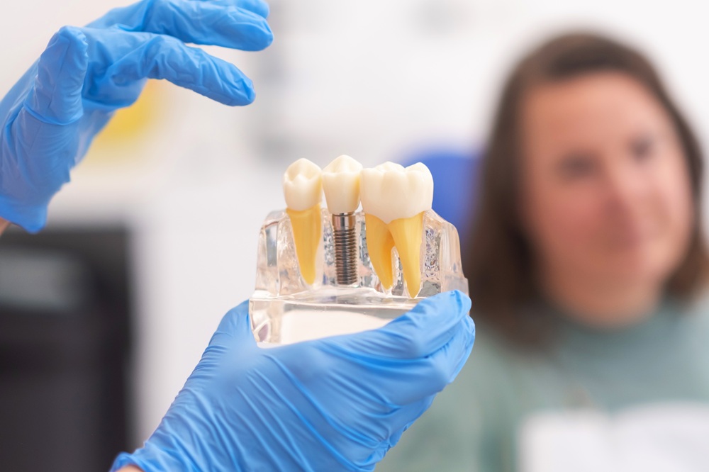 Dental Implant Model Consultation – Dental Implants Gramercy Park A dental professional wearing blue gloves holds a transparent model showing dental implants and natural teeth while a patient looks on – Dental Implants Gramercy Park