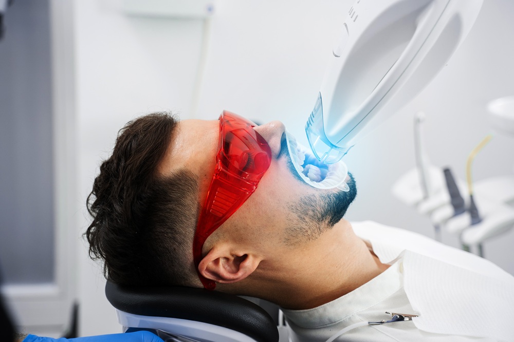 Teeth Whitening Procedure – Teeth Whitening A man wearing red protective glasses receives a professional teeth whitening treatment with a specialized LED light device – Teeth Whitening