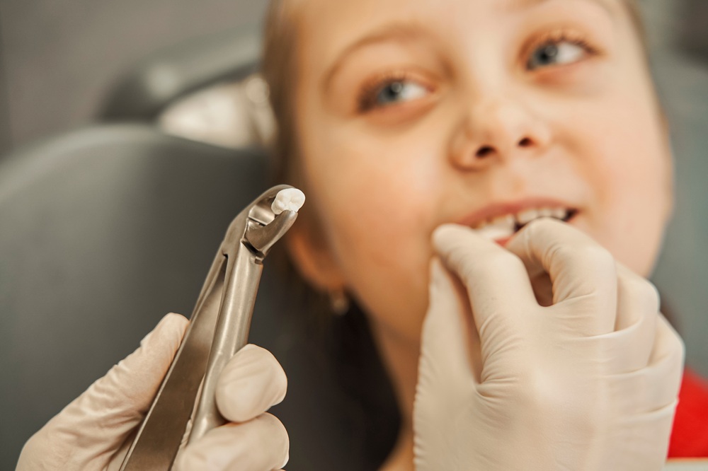 Child Tooth Extraction Procedure – Extraction A close-up of a child at the dentist’s office with gloved hands holding a dental extraction tool gripping a tooth, while the child touches their mouth – Extraction